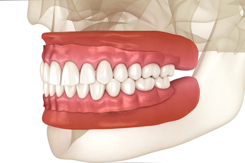3D illustration of human teeth and gums